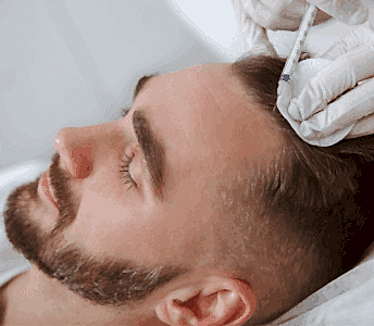 Ankara Saç PRP Tedavisi